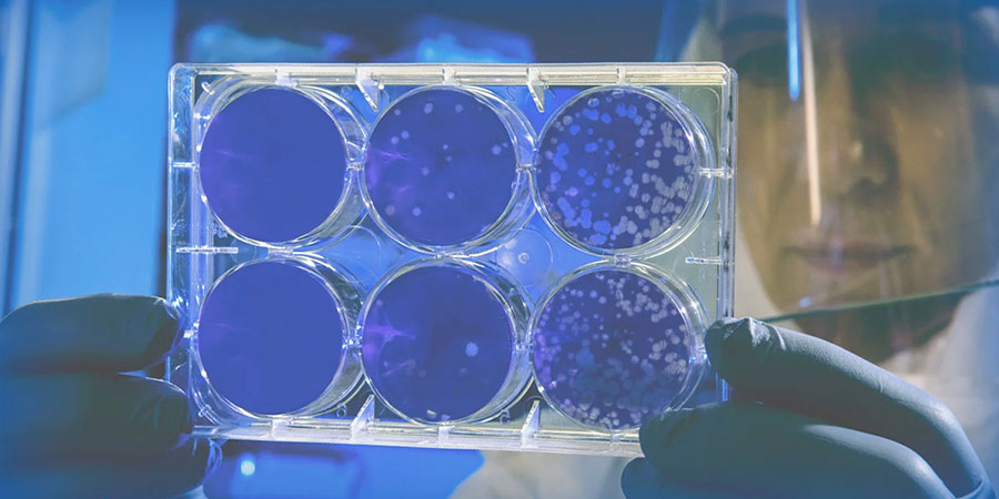 ISO 26262 と SOTIF (ISO 21448) の違いとは？機能安全との比較解説